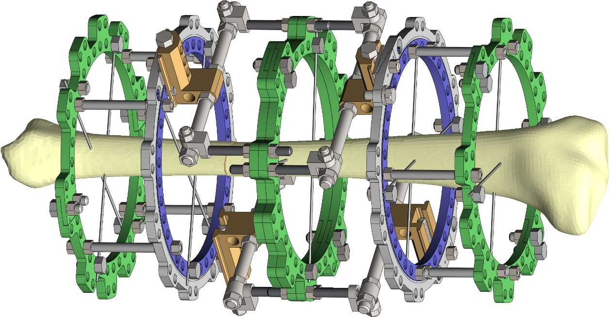 ������λ��̶���UG